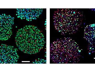 En jämförelse sida vid sida mellan celler som stöds av syresättningsanordningen (vänster) och celler utan stöd av anordningen (höger). Levande celler visas i grönt, döda celler i rött. Kredit: Jonathan Rivnay/Northwestern University