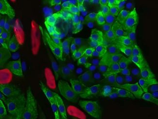 Immunofluorescens som visar insulinproducerande betaceller från bukspottkörteln i mus. Grönt representerar insulin; blått: cellkärnan; och rött: en tagg som indikerar celldelning. Kredit: Alonsos laboratorium