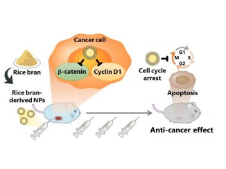 Forskare vid TUS utvecklar rbNPs som stoppar cellcykeln och hämmar uttrycket av proteiner, såsom β-catenin och cyclin D1, som främjar metastasering, särskilt i cancerceller. De inducerar också apoptos hos cancerceller och uppvisar därigenom en betydande anticancereffekt. Kredit: Prof. Nishikawa från TUS, Japan