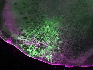En skiva av musens hjärnstam visar detektion av morfin (grön) och uttryck av SPOTIT-sensorn (magenta). Credit: Noam Gannot och Peng Li, U-M Sciences Institute