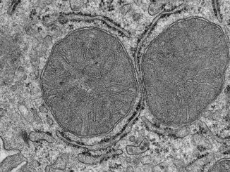 Mitokondrierna i levern ändrar form så fort de får i sig mat. Bilden visar ett elektronmikrofoto av mitokondrierna i leverceller. Credit: S. Henscke/Max Planck Institute for Metabolism Research